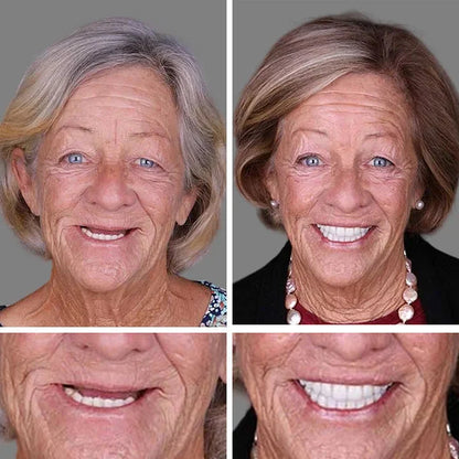 🌎Ends Today: 70% OFF! ⏰Medical Full Denture with Strong Suctiond🦷Obtain American Dental Association (ADA) Certification