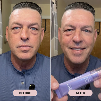 Instant Lift Eye Gel