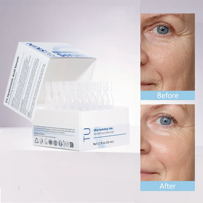 LIMITED OFFER: Buy 1 Get 1 FREE – 3% Hyaluronic Acid Serum for Deep Hydration & Glow