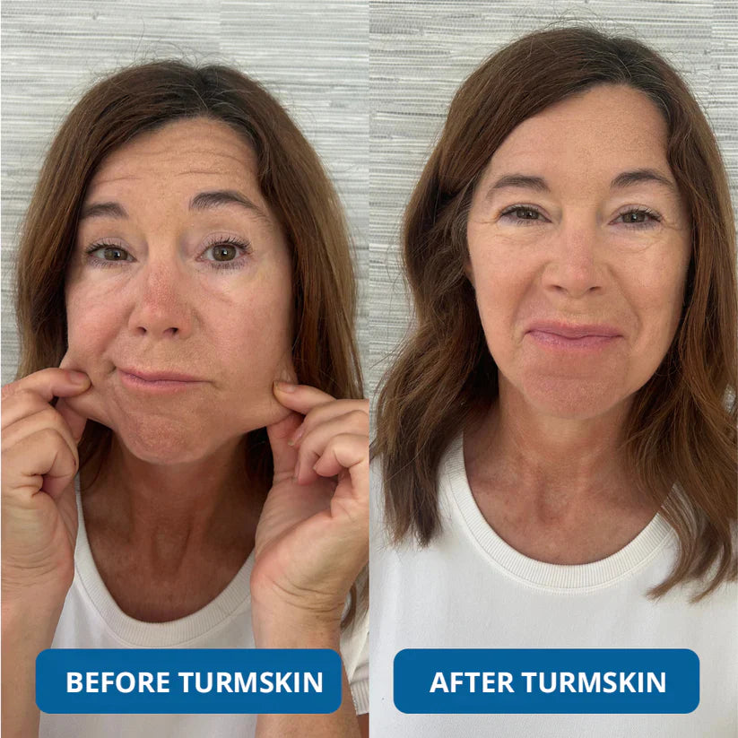 LIMITED OFFER: Buy 1 Get 1 FREE – 3% Hyaluronic Acid Serum for Deep Hydration & Glow