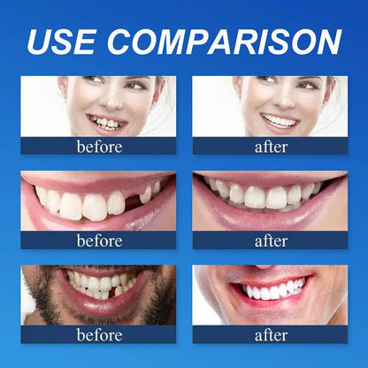 🌎Ends Today: 70% OFF! ⏰Medical Full Denture with Strong Suctiond🦷Obtain American Dental Association (ADA) Certification