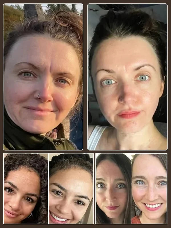 💐Christmas limited edition🏆🔥One touch to remove wrinkles🔥Micro-molecular collagen anti-wrinkle lotion