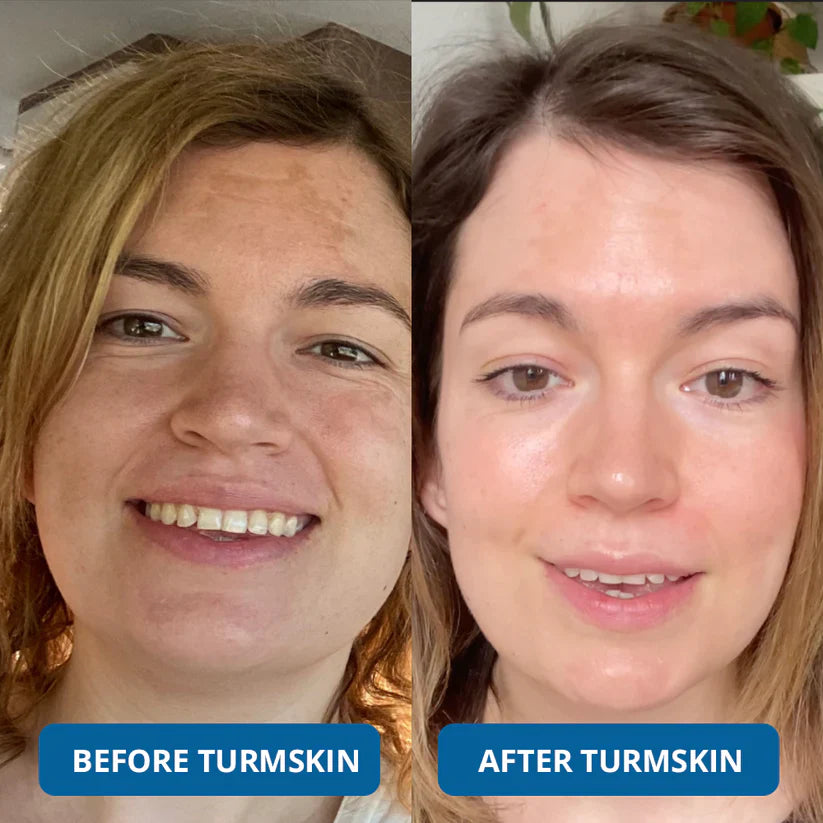 LIMITED OFFER: Buy 1 Get 1 FREE – 3% Hyaluronic Acid Serum for Deep Hydration & Glow