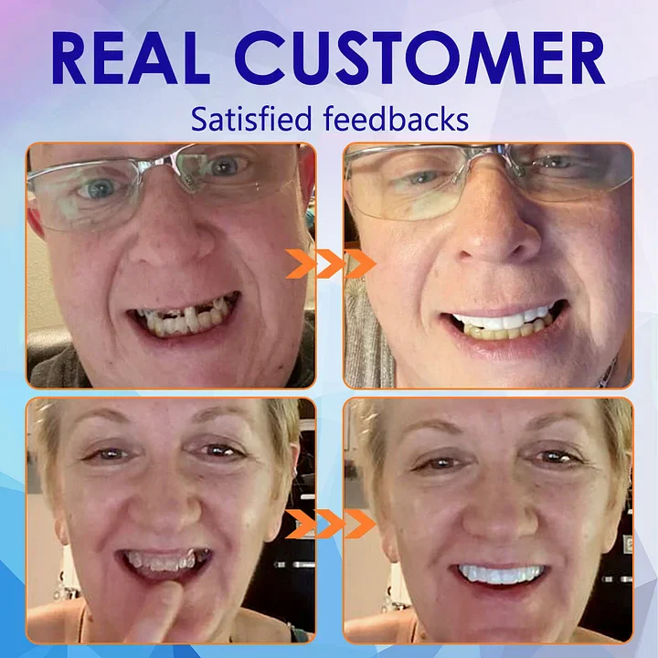 NESLEMY-🦷Advanced Customized Full Denture Set🦷