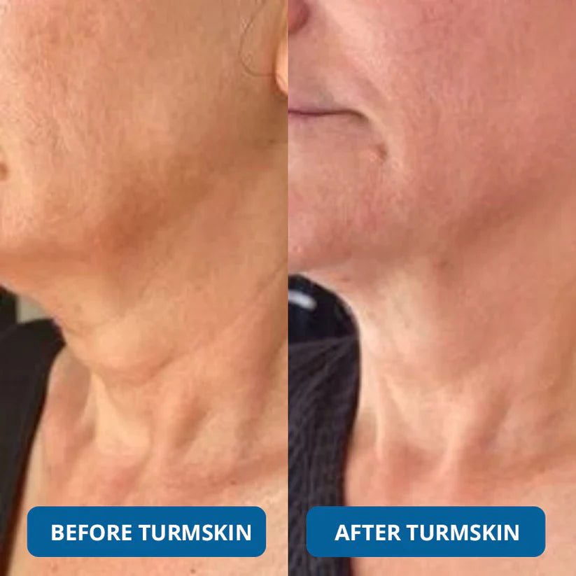 LIMITED OFFER: Buy 1 Get 1 FREE – 3% Hyaluronic Acid Serum for Deep Hydration & Glow
