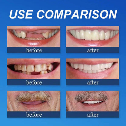 🌎Ends Today: 70% OFF! ⏰Medical Full Denture with Strong Suctiond🦷Obtain American Dental Association (ADA) Certification
