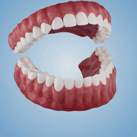 NESLEMY-🦷Advanced Customized Full Denture Set🦷