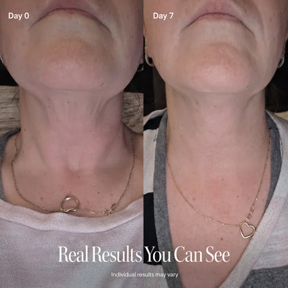 🔥LAST DAY BUY 1 GET 1 FREE🔥CELESTVÉRA Face Slimming Cream