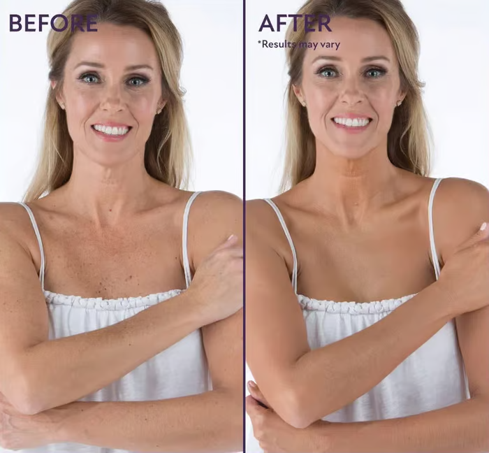 🎉Last Day🎁All Over Complexion Perfector