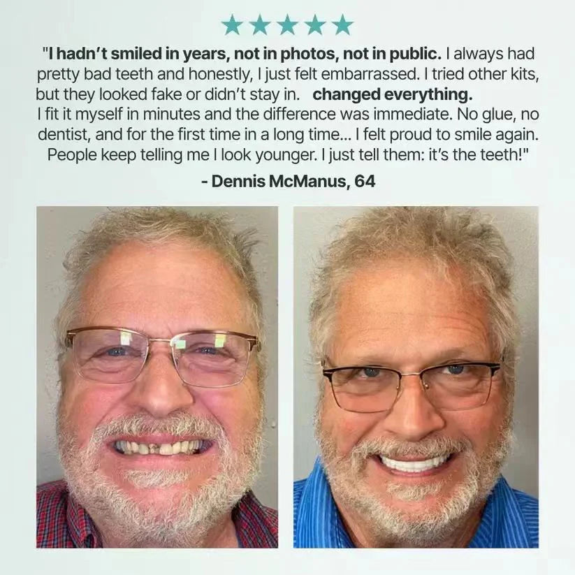🌎Ends Today: 70% OFF! ⏰Medical Full Denture with Strong Suctiond🦷Obtain American Dental Association (ADA) Certification