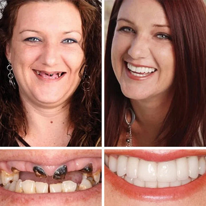 🌎Ends Today: 70% OFF! ⏰Medical Full Denture with Strong Suctiond🦷Obtain American Dental Association (ADA) Certification