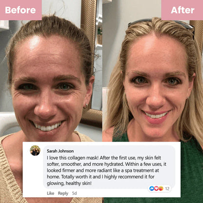 Turn Back Time While You Sleep — Collagen Mask for Radiant Morning Skin!