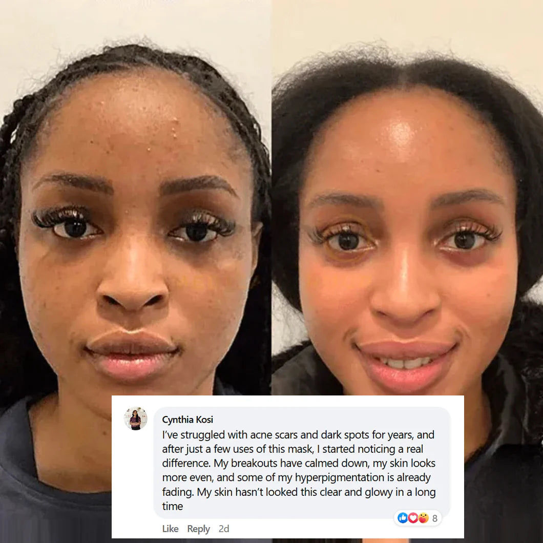 Turn Back Time While You Sleep — Collagen Mask for Radiant Morning Skin!